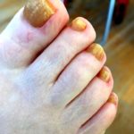 Toenails #3